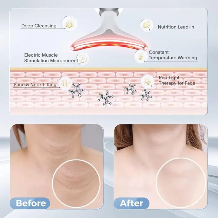 Neck & Face Lifting and Firming Massage Beauty Machine (3 Speed High Quality) (With Light)
